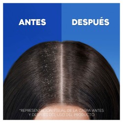 Shampooing Head & Shoulders S Anticaída 1 L