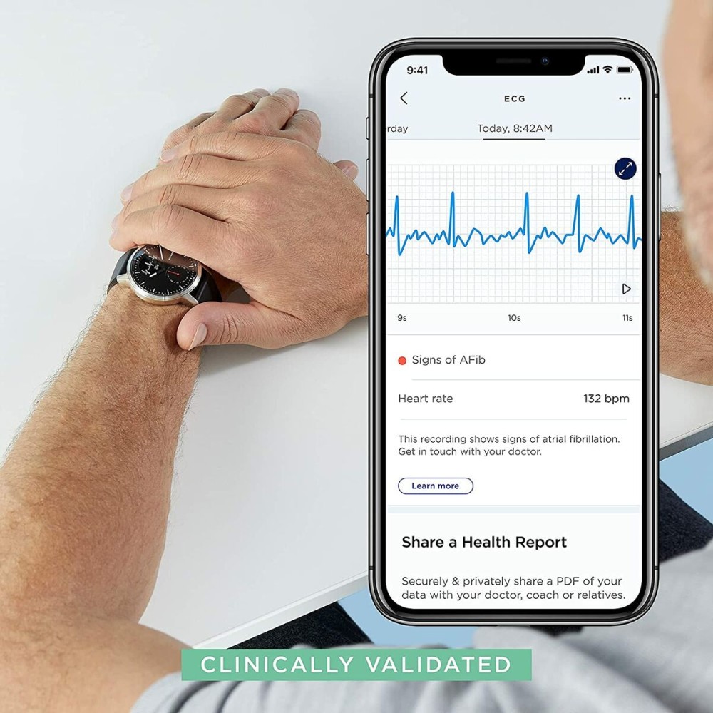 Montre intelligente Fitbit Versa 4 Rose 1,58"