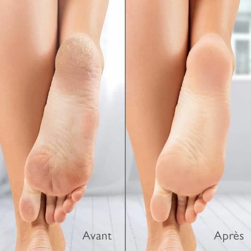 Electric Callus Remover Silk´n Vacupedi (5 Units)