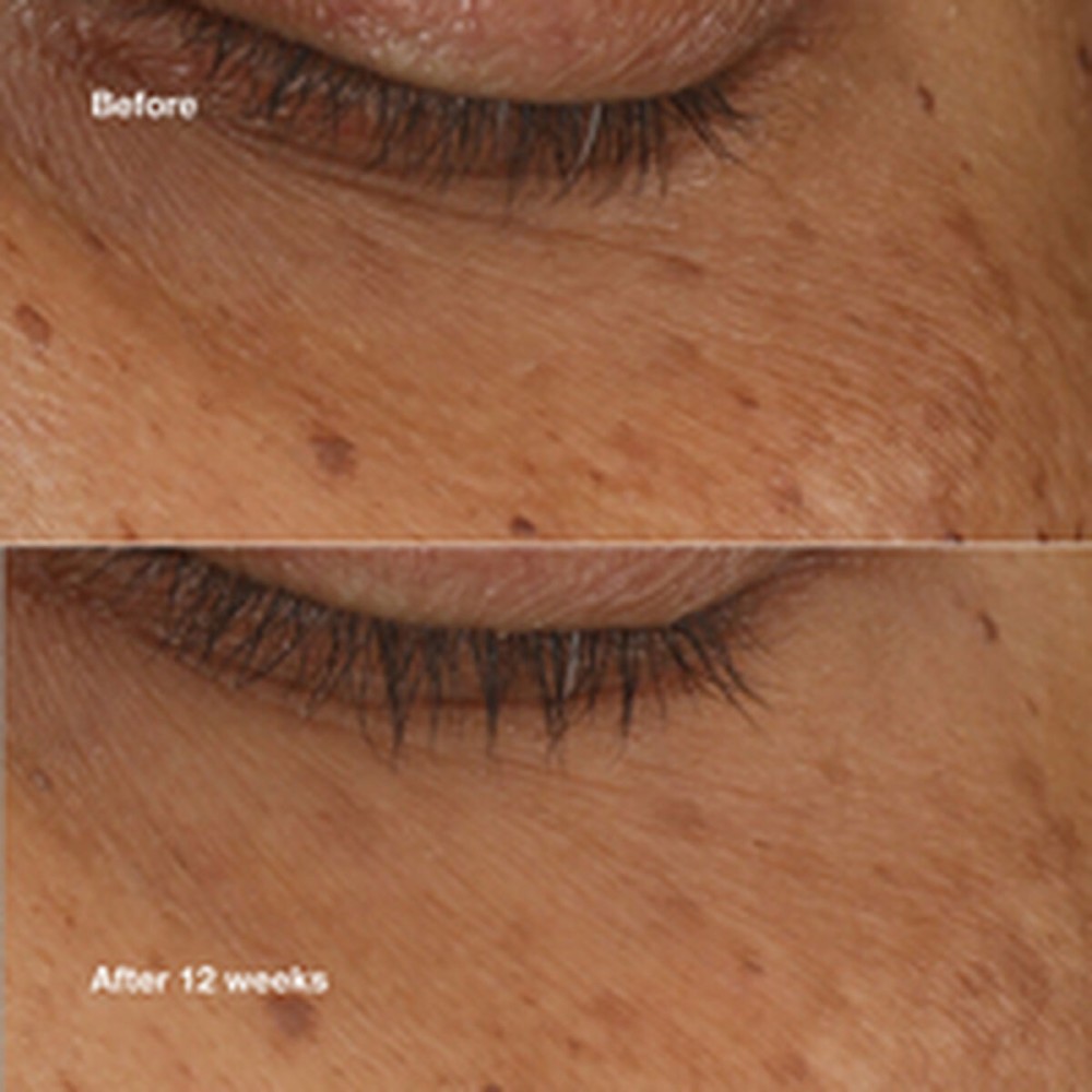 Illuminating Serum Clinique ALL ABOUT EYES 10 ml