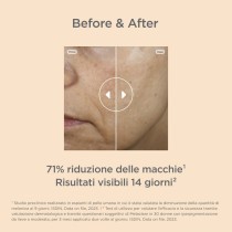 Anti-Brown Spot Serum Isdin Isdinceutics Melaclear Advanced 30 ml